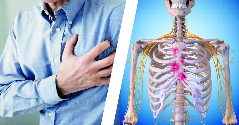 5 Lesser-Known Causes of Chest Pain