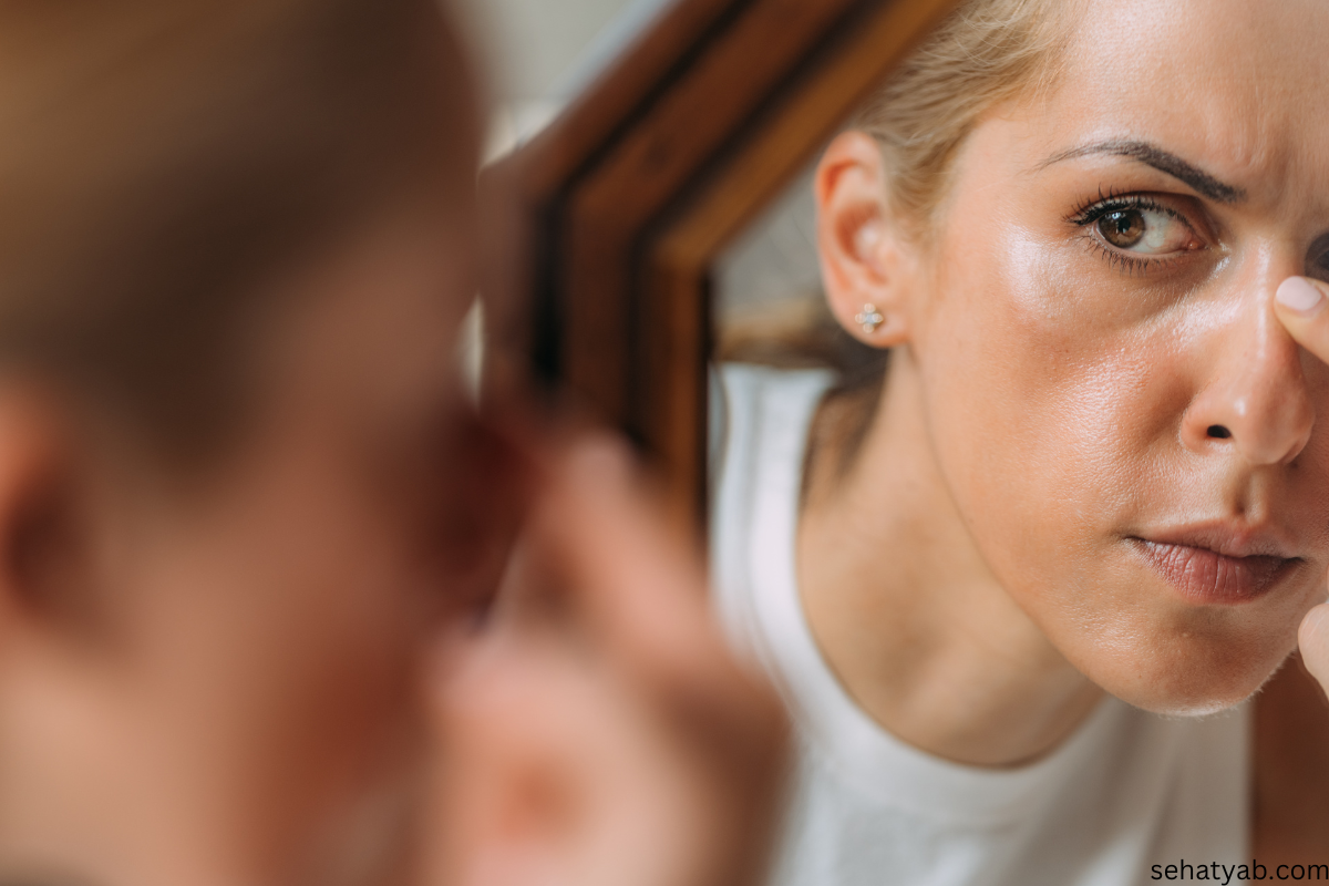 Body Dysmorphic Disorder